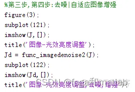 运动图像序列增强重建的matlab设计和仿真_开发语言_03